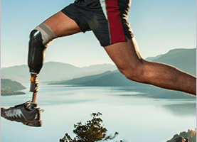 Xabian- Developing Prosthetic Limbs
